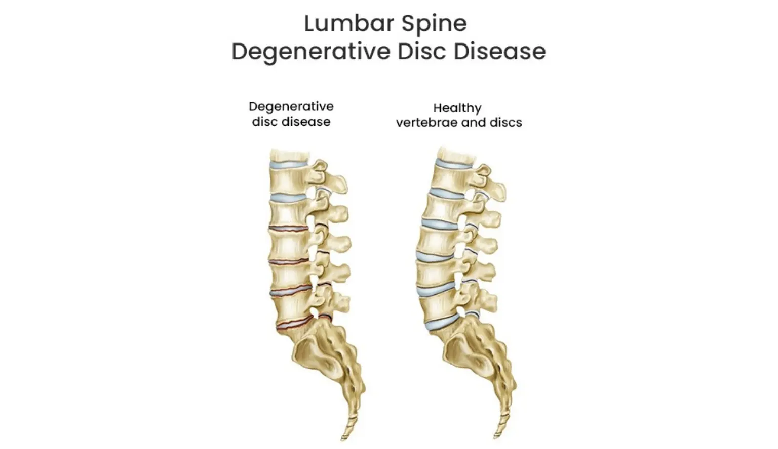 Lumbar-Spine